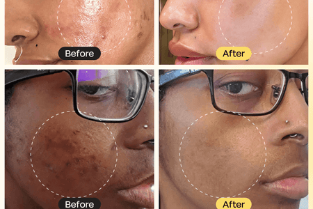 Vitamin C Clay Mask